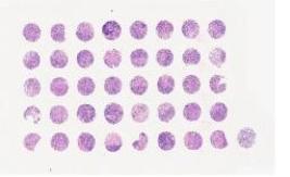 中科光华卵巢组织组合芯片